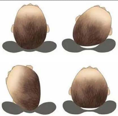 Baby Pillows – Pack of 2 | Soft & Supportive Head Shaping Pillows for Newborns | Breathable Cotton Fabric
