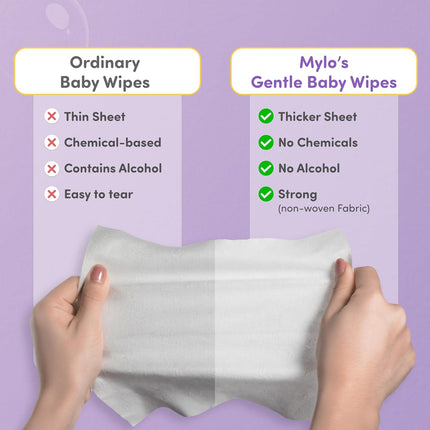 Mylo Baby Wipes – Pack of 3 (80 Wipes Each) – Ultra-Soft, Aloe Vera Enriched & Gentle Care